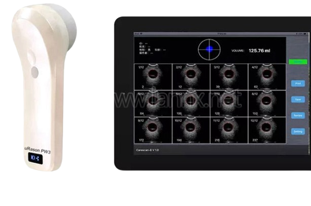Bladder Scanner