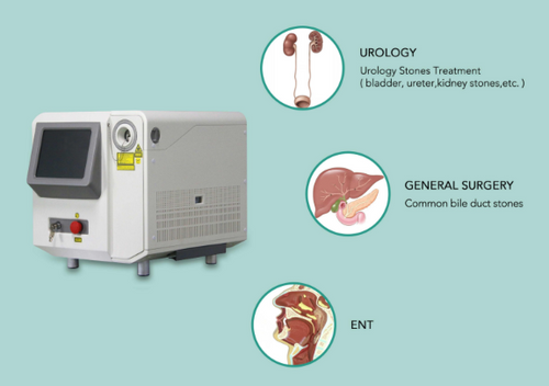 Holmium Laser Lithotripsy